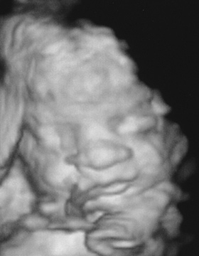 Our baby at 28 weeks